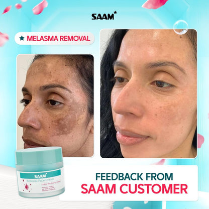 SAAM Renewal Face Cream, Melasma and Dark Spots Treatment - 50g