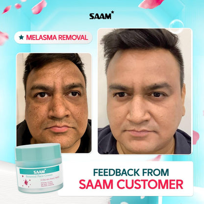 SAAM Renewal Face Cream, Melasma and Dark Spots Treatment - 50g